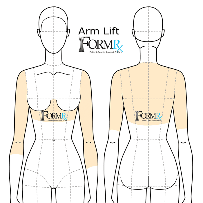 Fitting diagram, item 1140 arm lift coverage